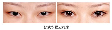 ˫Ƥǰͼ