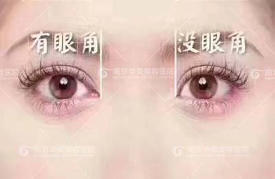 Ͼ꿪۽ò?
