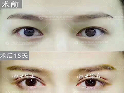 Ͼп˫Ƥ軨ѶǮ?