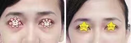 ϾЧ۴ķʽʲô?